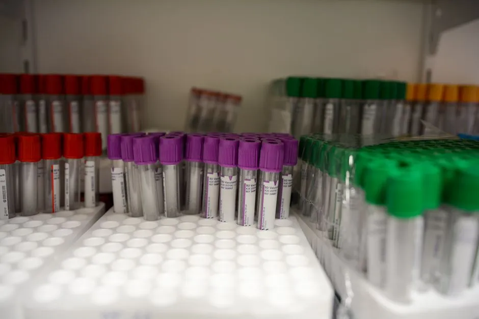 Racks of capped blood collection tubes in a laboratory