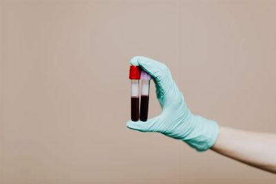 Close-up of a gloved hand holding two blood sample tubes in a laboratory setting.