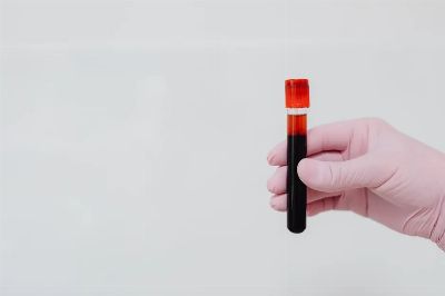A gloved hand holding a blood sample in a test tube with a white background.