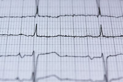 ecg, electrocardiogram, medicine, heartbeat, heart