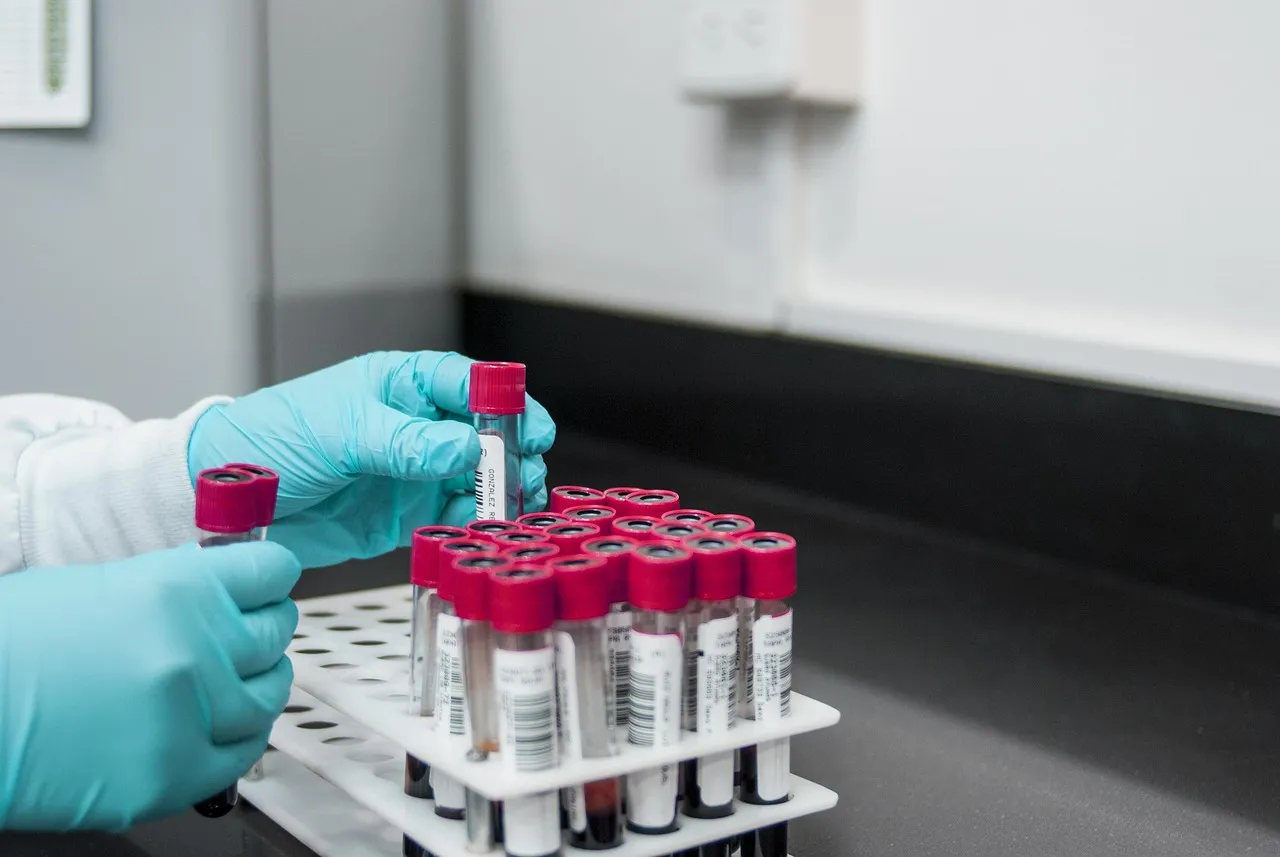 Gloved hands placing red-capped blood sample tubes into a rack on a laboratory bench