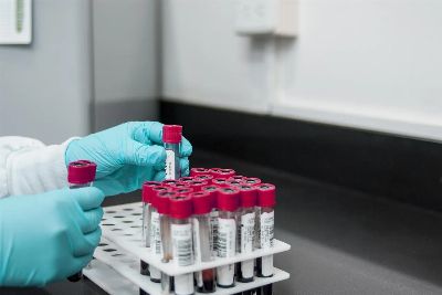 lab, experiment, test, chemistry, test tubes