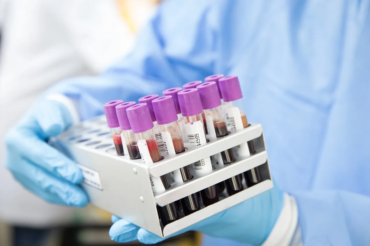 Gloved hands holding a rack of labelled blood sample tubes in a laboratory