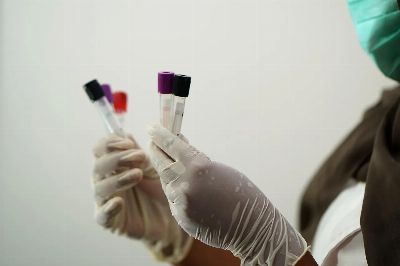 laboratory, test tubes, medical staff, researcher, coronavirus