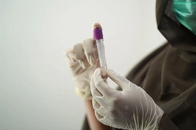 blood test, blood sample, medical technology, medical technologist, surgical gloves